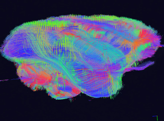 Illustration for article titled Amazing DSI Brain Scanning Visualizes Your Mind's Inner Workings In 3D